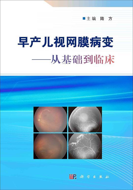 早产儿视网膜病变