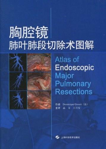 胸腔镜肺叶肺段切除术图解