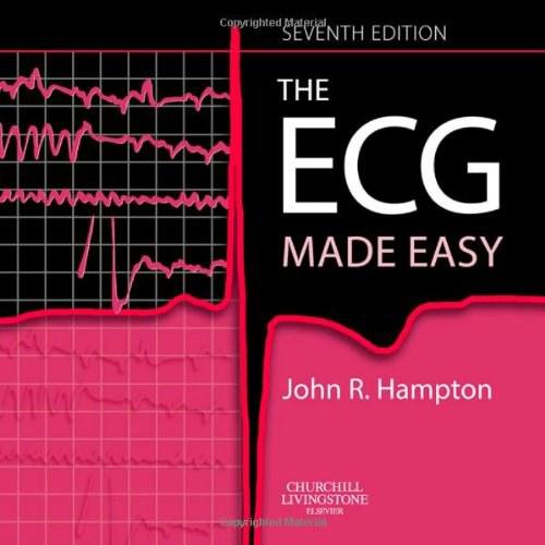 The ECG Made Easy